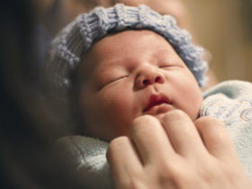 Cara Mengobati Belekan Pada Bayi Baru Lahir